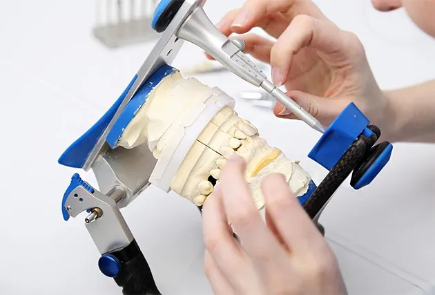 Hands adjusting an articulator holding plaster models of the teeth