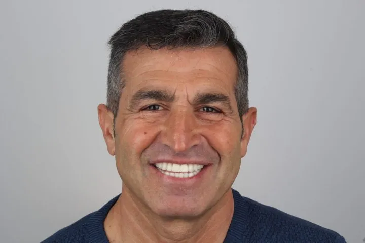 Patient smiling after treatment