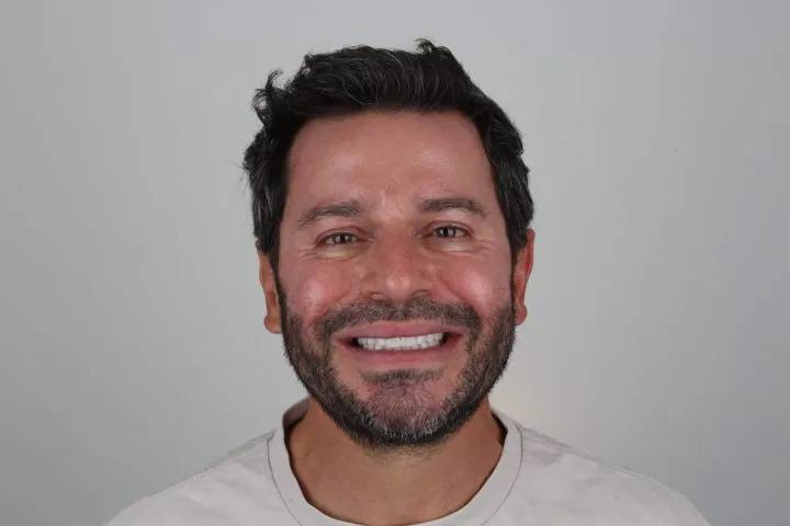 Patient smiling after treatment
