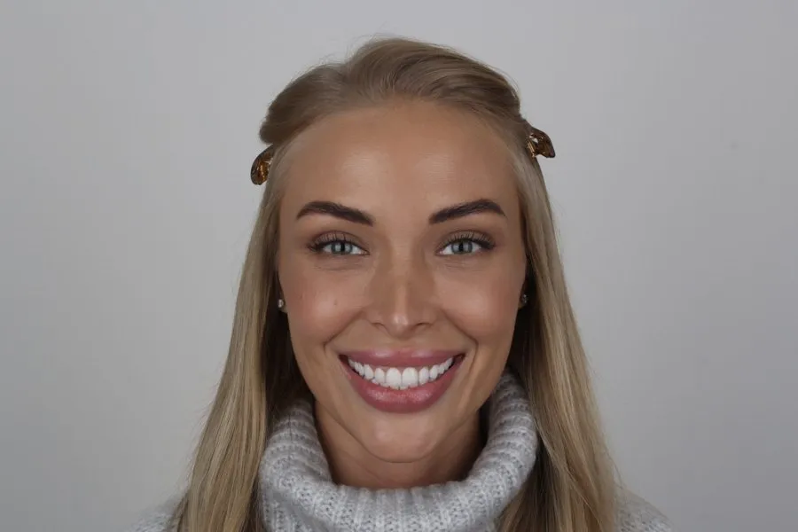 Patient smiling after treatment