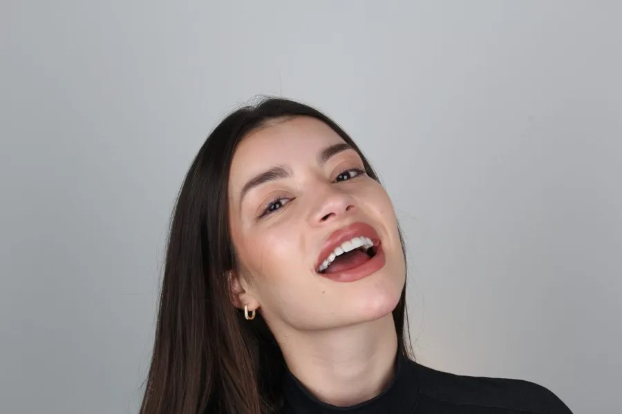 Patient smiling after treatment