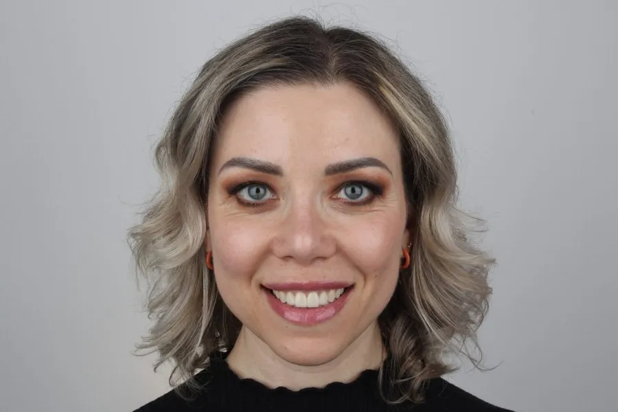 Patient smiling after treatment