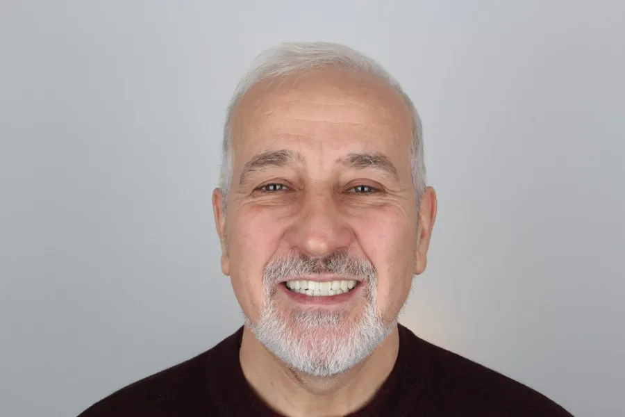 Patient smiling after treatment