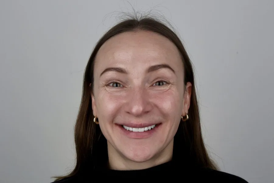 Patient smiling after treatment
