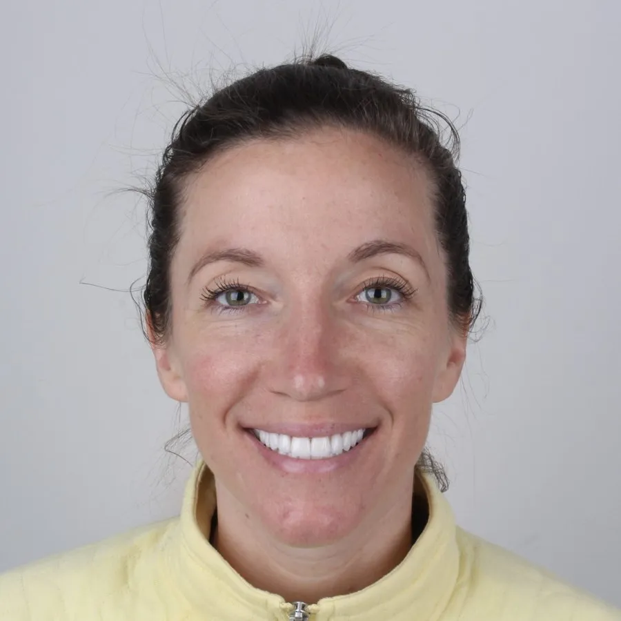 Patient smiling after treatment