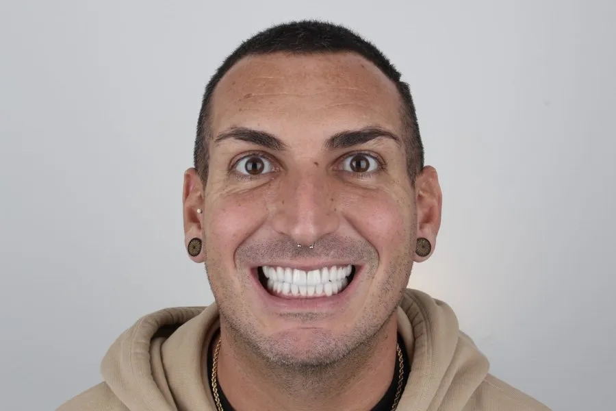 Patient smiling after treatment
